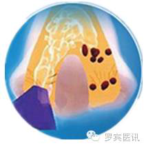 鼻腔冲洗，你了解多少？