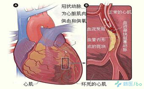 心前区位置示意图,心前区疼痛位置图,心前区的准确位置图片(第10页)_大山谷图库