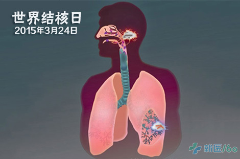 2015年世界结核日专题—预防控制结核病