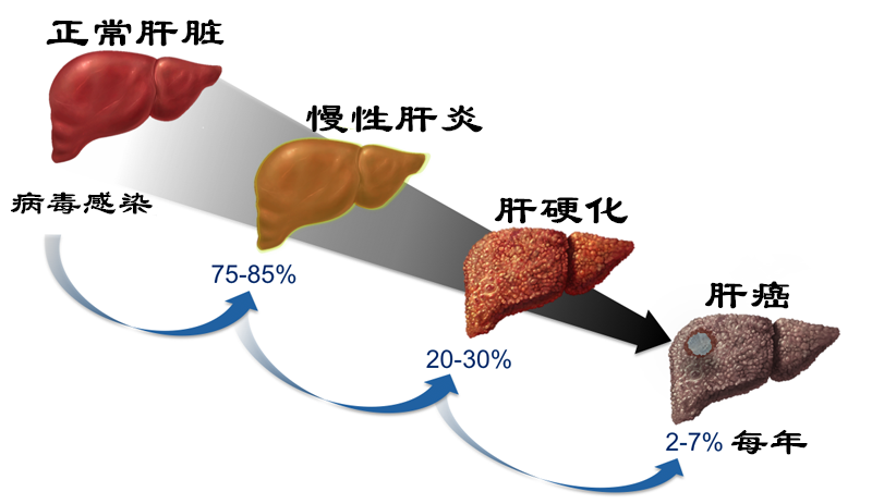 肝病门诊介绍