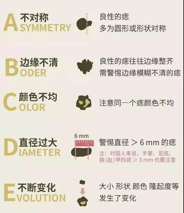 什么样的痣容易恶变?