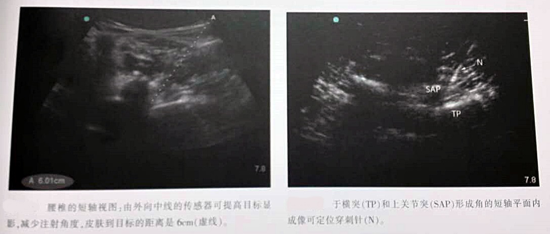 小关节阻滞.jpg