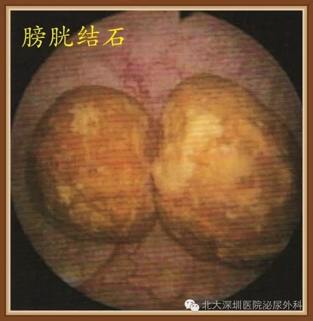 640_爱奇艺(2).jpg
