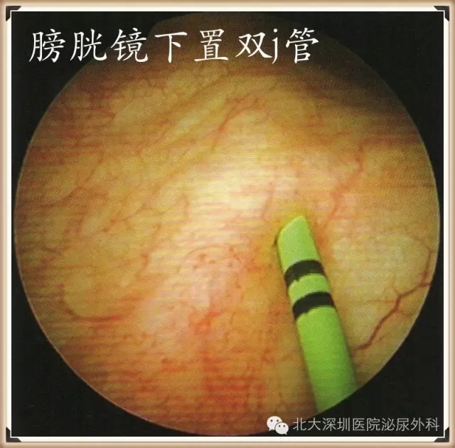 640_爱奇艺(4).jpg