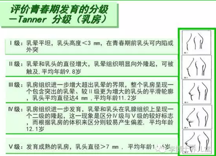 乳房发育评级:在中国,一般认为这一代女孩的正常发育是从10岁左右咪咪
