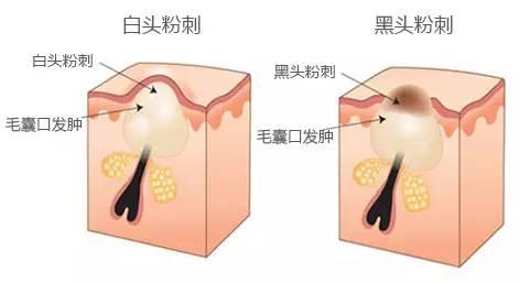 示意图.jpg
