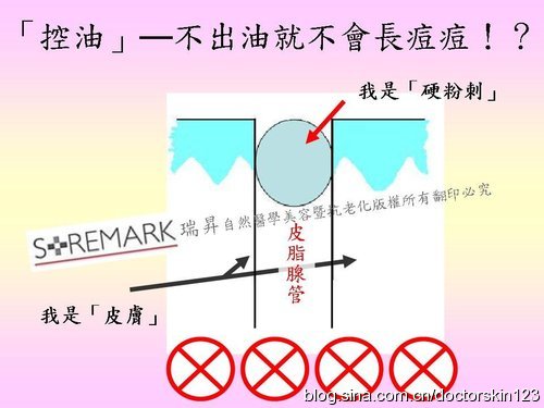 6c2cbf74g9a4616a7f401&690.jpg