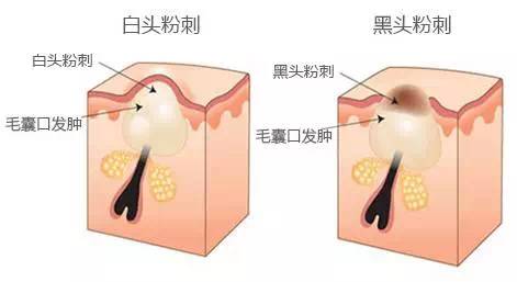 ae94179597854d6f9ffd7cbca3014728_th.png.jpg
