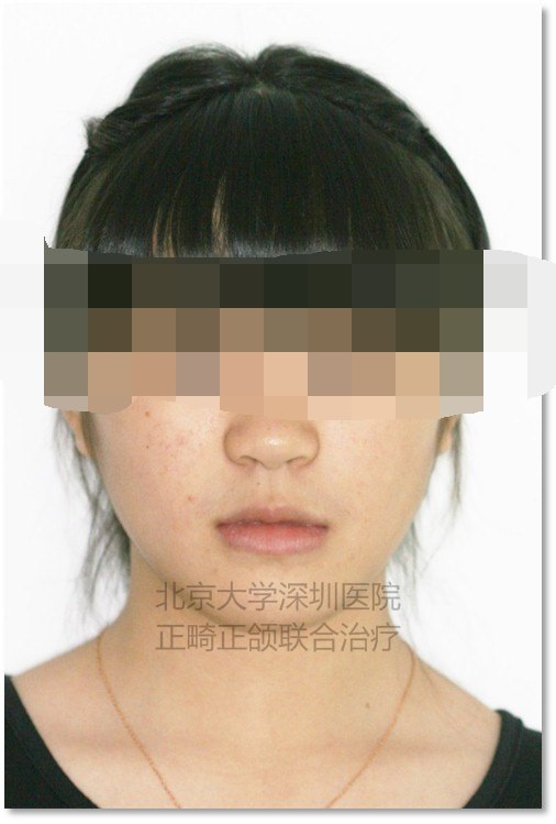 正面.jpg