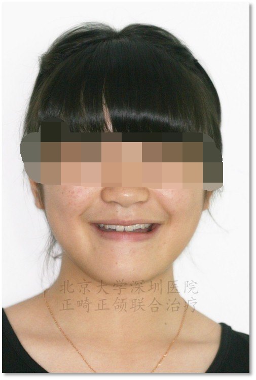 正面3.jpg