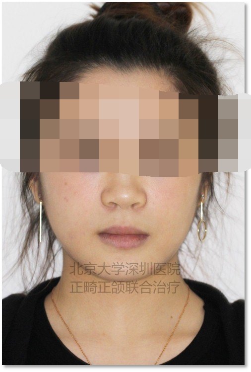正面2.jpg