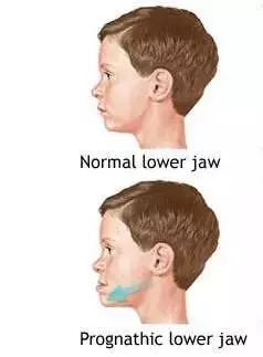 15373291234593.webp.jpg