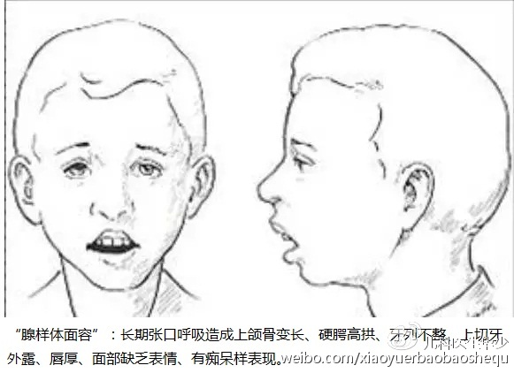 ebc622e4a8d24d7390ce633f5268b11e_th.jpg