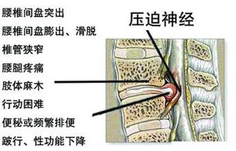 u=2073427412,3985654305&fm=21&gp=0.jpg