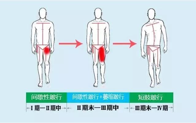 跛行.jpg
