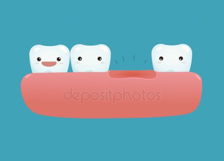 depositphotos_62239965-stock-illustration-missing-tooth-of-dental.jpg