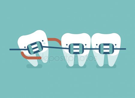 depositphotos_97901920-stock-illustration-braces-teeth-of-dental-healthcare.jpg