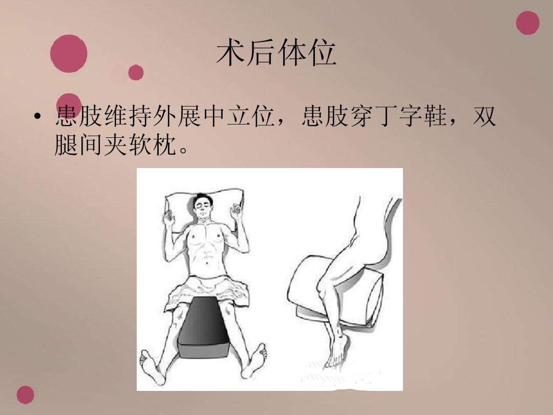 髋关节术后锻炼10.jpg