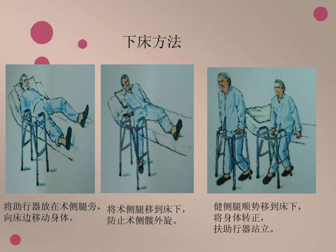 髋关节术后锻炼3.jpg
