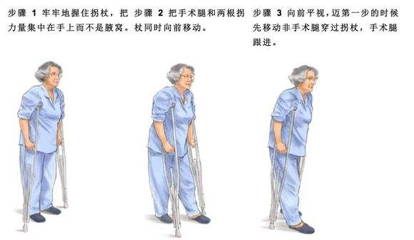 髋关节术后锻炼6.jpg