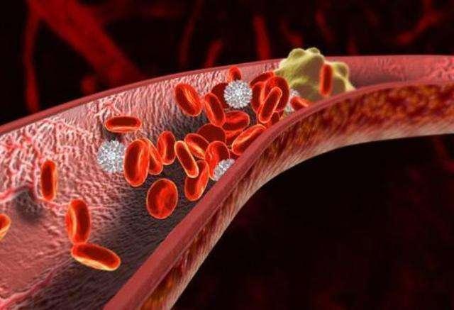 -1-health-pics-hv1-139-222-2267-147468424.jpeg