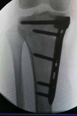 1550921169372171.jpeg wYYBAFxw4WOAIaVSAADGQNbWSNU831.jpeg