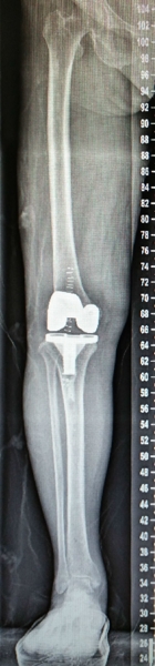 1550921188662518.jpg uoYBAFhUoI6ATXxCAANNzopsKZI169.jpg