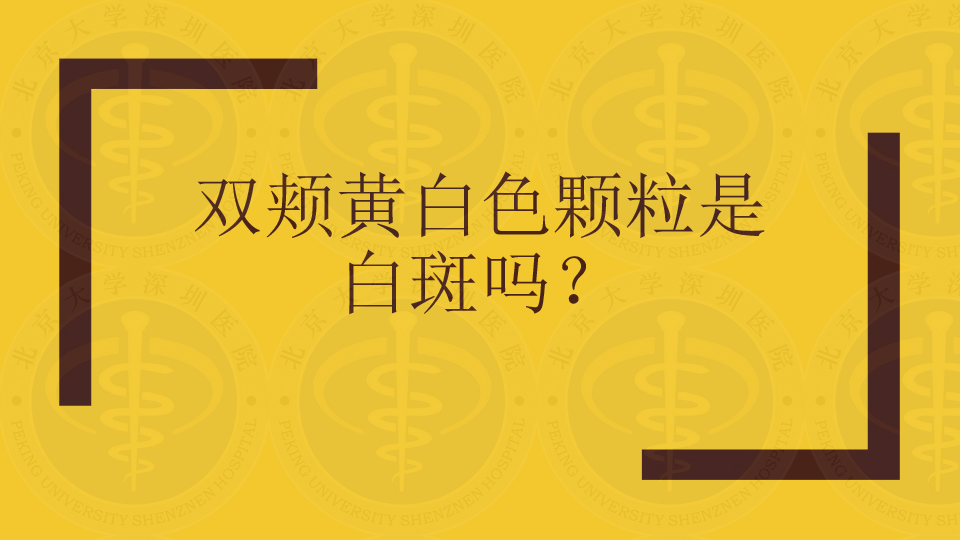 迷脂症(異位皮脂腺)雙唇唇紅黏膜可見黃白色顆粒,質軟,表面無黏膜破損