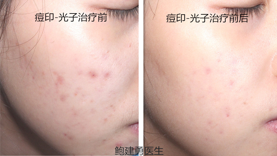 何, 英巧 20180716 标准照片_副本.jpg