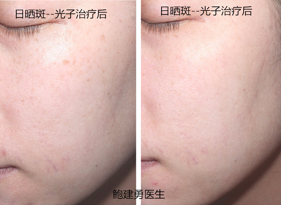 杜, 桂莲 20180412 标准照片_副本_副本.jpg