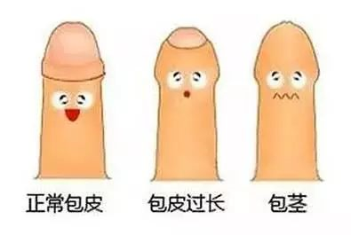 包茎图片.png