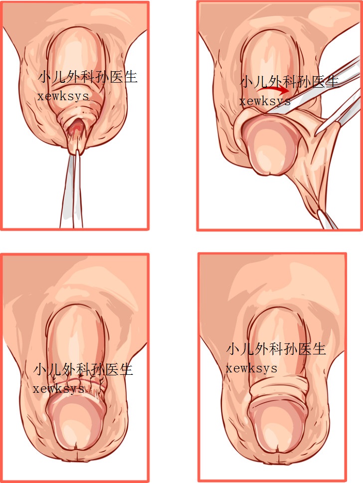 a0318b910be7b3a0d347c7cf426def9d5f107d401.jpg