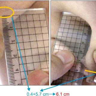 Method-used-to-measure-stretched-penile-length-in-the-current-study_Q320.jpg