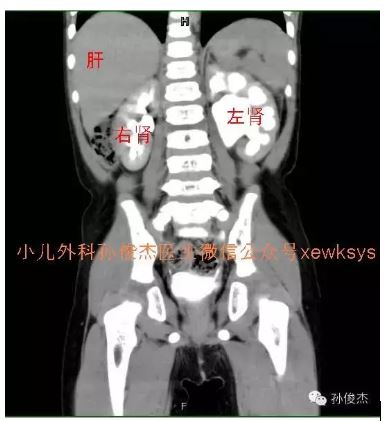 捕获07.JPG