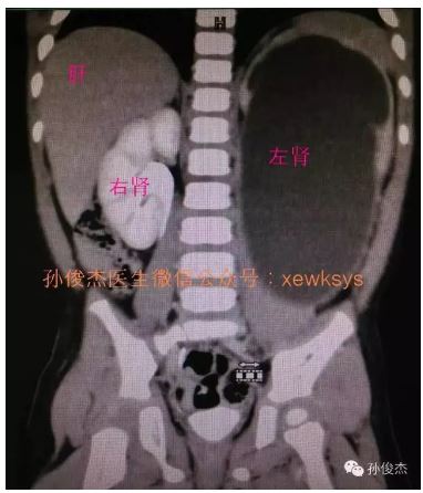 捕获08.JPG