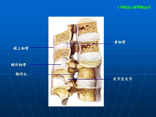 棘间韧带炎位置图图片