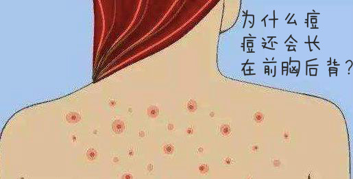 jisulian01.145137_meitu_3.jpg