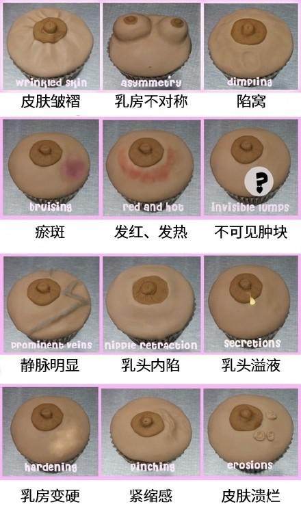 乳腺癌7.jpg