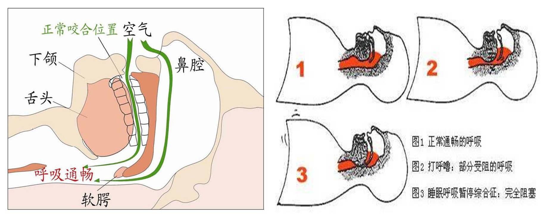 睡眠3.jpg