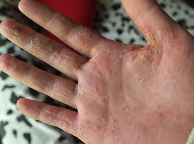 1560742262428500.png blob.png