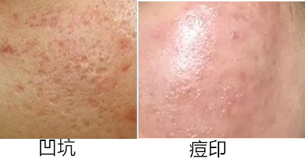006TNzihzy7e1IVOVpHdd&690.jpg