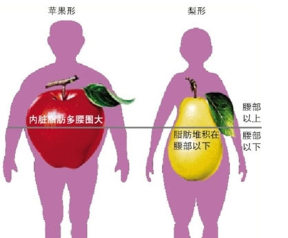 向心性肥胖图片解说图片