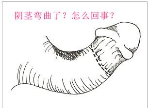 u=3194390922,1451942801&fm=26&gp=0.jpg