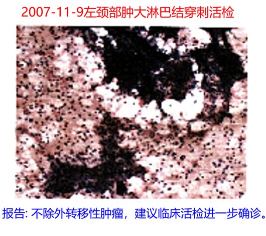 2007-11-9颈部淋巴结活检.jpg