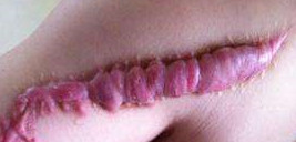 1568596319218727.png 图片1.png