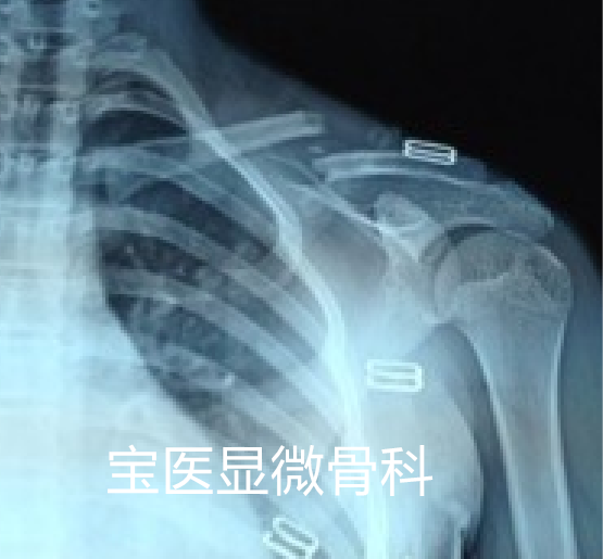 1561899812368063_副本.png