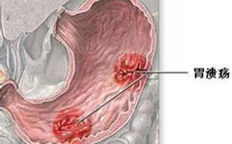 1571138808584414.jpg timg (1).jpg