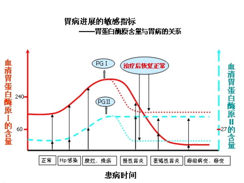 2胃蛋白酶原及胃病关系.jpg