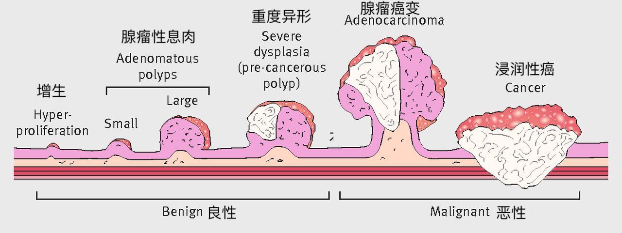 1571919338754736.jpg F2.large.jpg