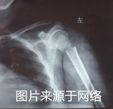 X@7J_CJMG6X]MMZ2A9KUY2Q_副本.png